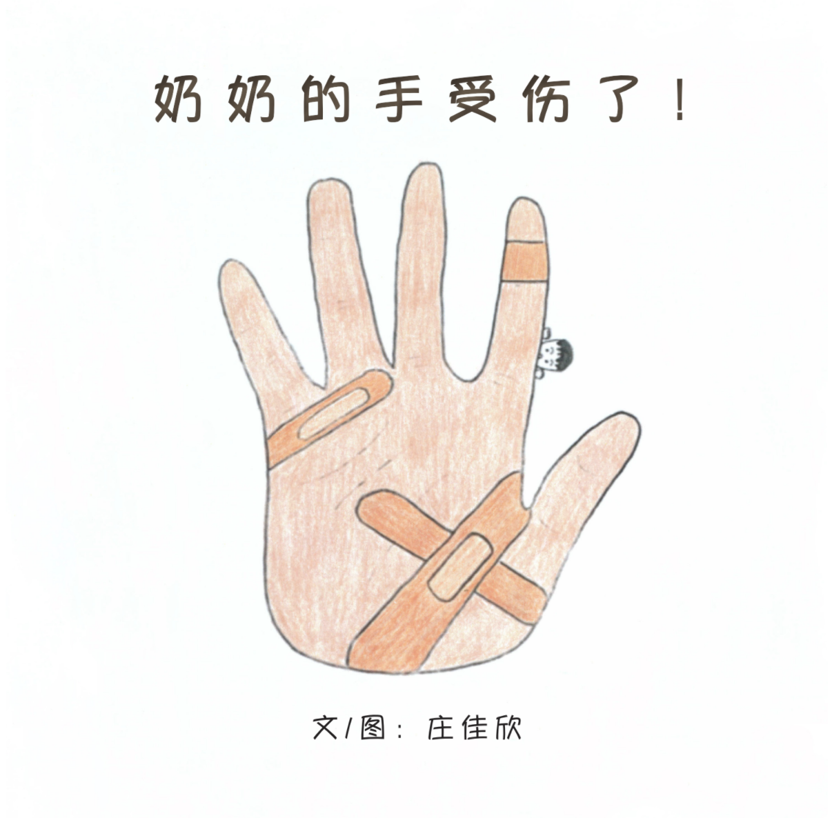  Grandma’s Hand Is Injured